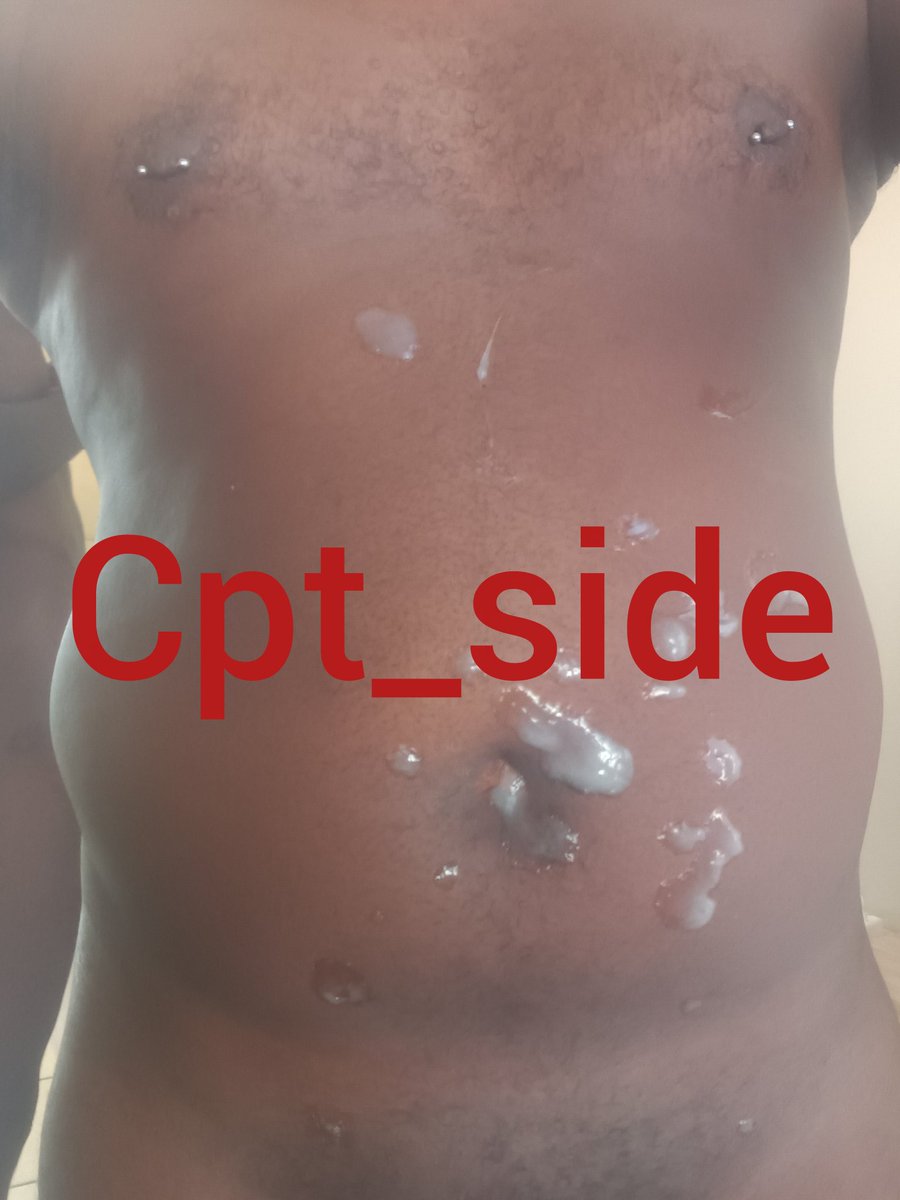 Cpt_side tweet media