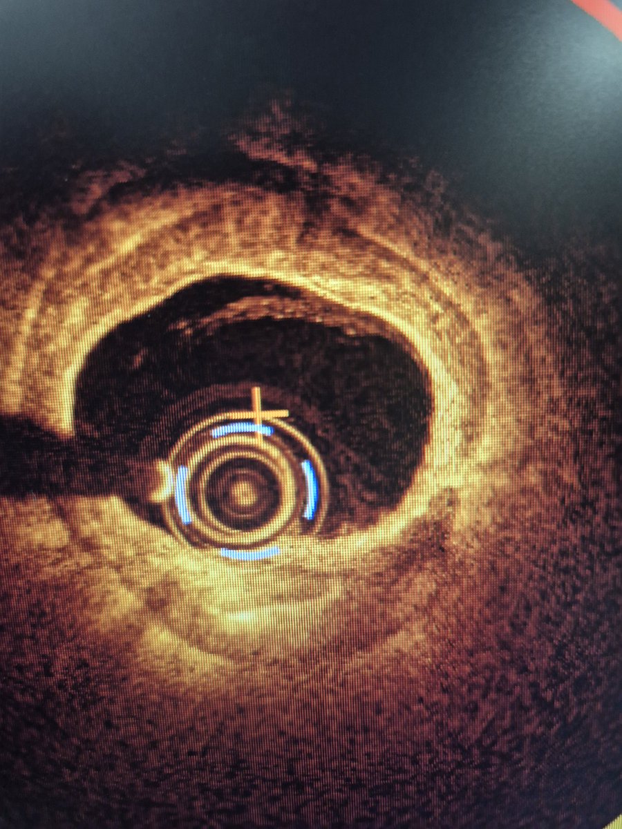 Elad Asher tweet media