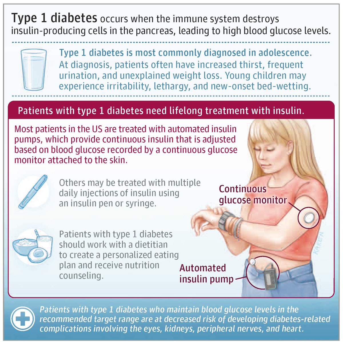 Type 1 #diabetes occurs when the immune system destroys #insulin-producing cells in the pancreas, leading to high blood glucose levels. 

📄 Learn more in this JAMA Patient Page: ja.ma/4rjsEMR