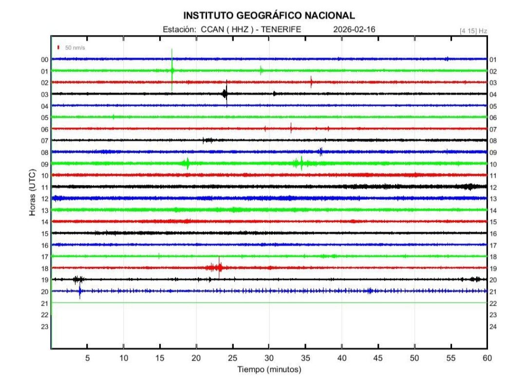 Importante enjambre sísmico desde hace más de una hora en Tenerife. 
👀🌋. No para, sigue subiendo. 
Veremos cómo evoluciona ésto, pero en mi opinión no tiene buena pinta y es un calco a lo que sucedió en La Palma.
