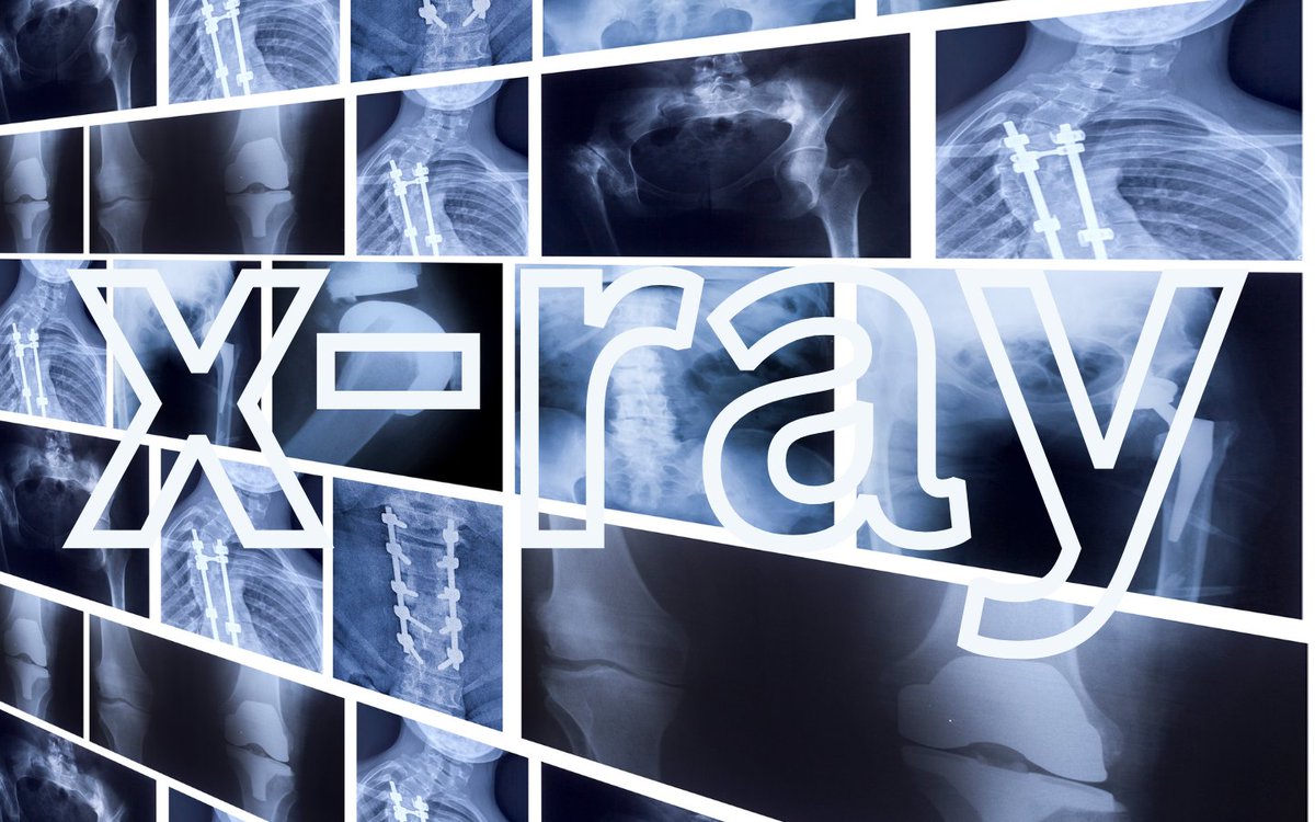 Tweeted.com tweet media