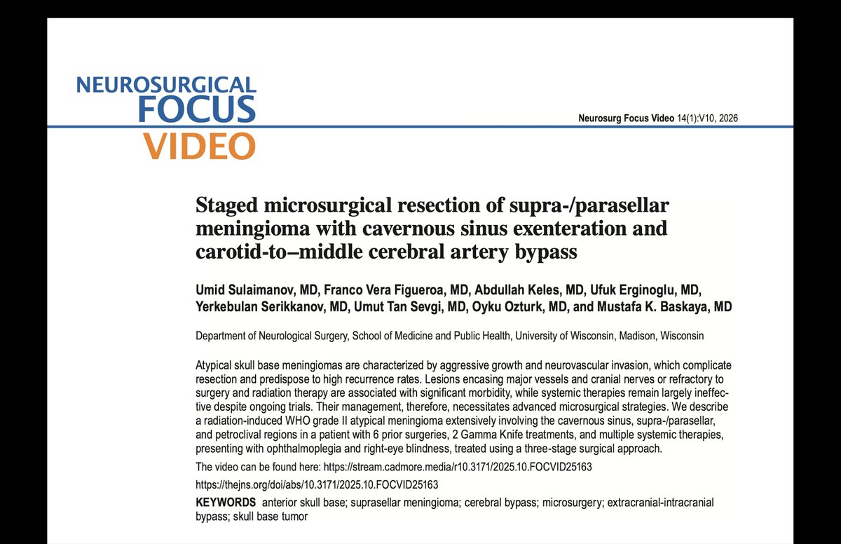 drufukerginoglu's tweet photo. New in Neurosurgical Focus Video: staged CCA–MCA bypass enabled safe resection of complex ICA-encasing skull base meningioma. Highlights the critical role of cerebral revascularization in modern skull base surgery.
https://t.co/7NBRQX0xsD
#Neurosurgery #SkullBase #Cerebrovascular https://t.co/qLOEEs5vue