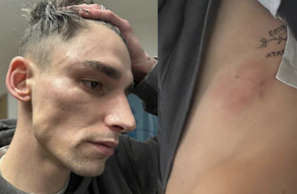 Pascal Kaiser, el árbitro amateur alemán que pidió matrimonio a su novio en un partido del Köln, ha vuelto a ser agredido.

Tras sufrir amenazas de muerte y una paliza hace unos días, L’Equipe informa que dos hombres han vuelto a ir a su casa a pegarle este fin de semana.

Kaiser