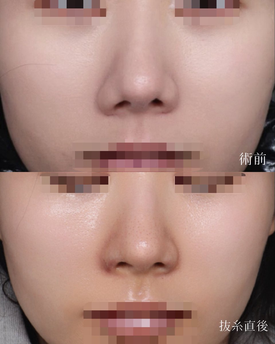 【公式】温度美容外科/ オンド美容外科 tweet media