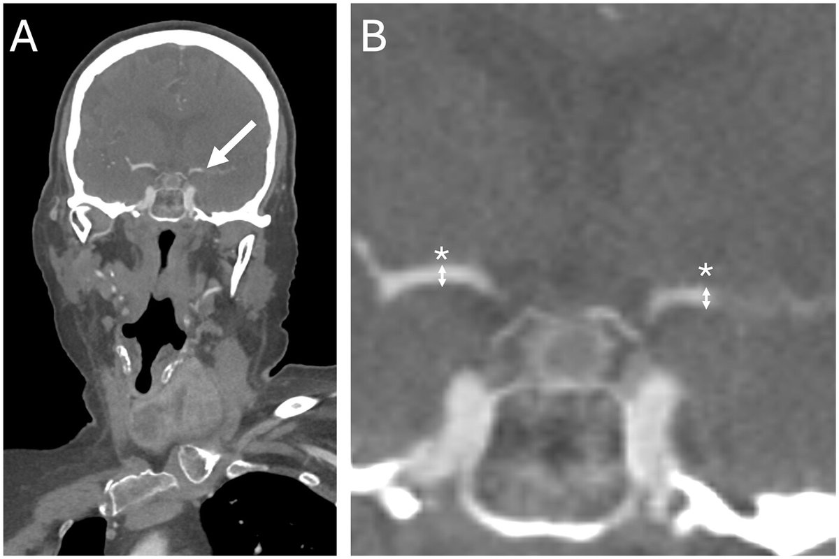 Canadian Association of Radiologists Journal tweet media