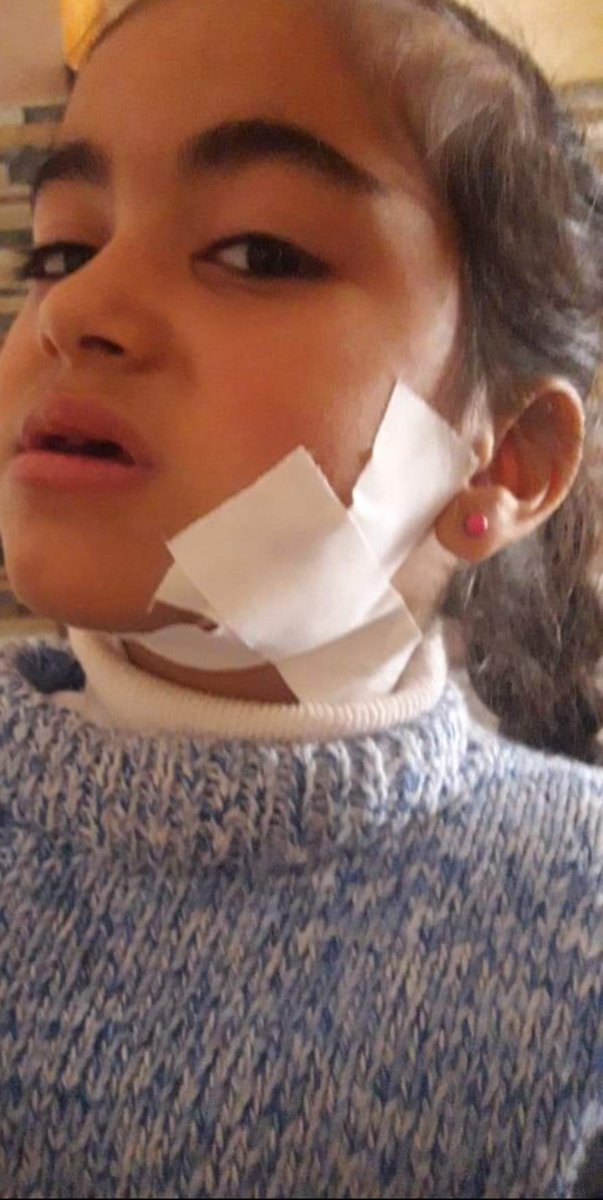 HamadShahe96841's tweet photo. Julia fell onto a pile of rubble while we were visiting my friend's house and injured her neck. Please help me, even if it's just to provide her with medical treatment.
https://t.co/8lOmJ9dmcn
@lunalunabraga @JimmyJ4thewin @Frances_Coppola @anarchotadigism @sale_gose @BulentY_ @bunnyxomosh @MothTongue_