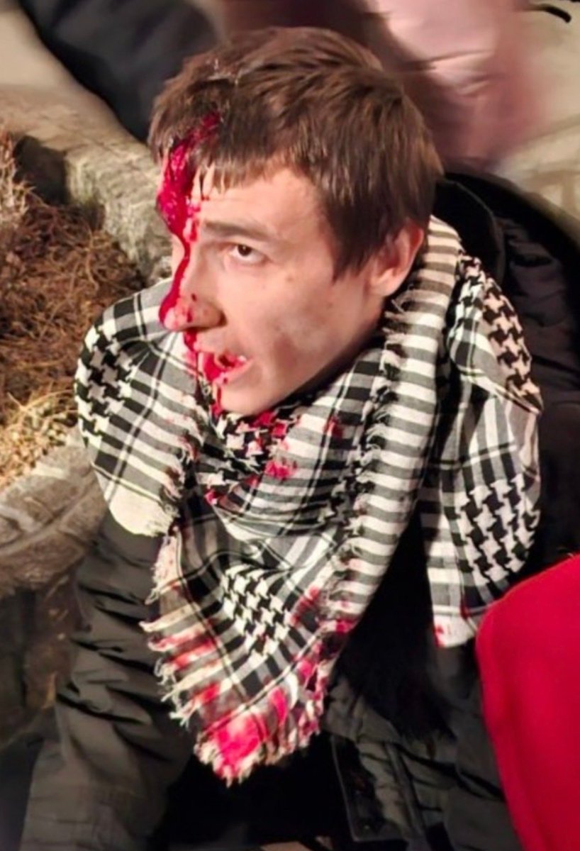 Ovako večeras režim preko lojalista u uniformama "uteruje" demokratiju u Novom Sadu!

Krvavi tragovi na svakom koraku...