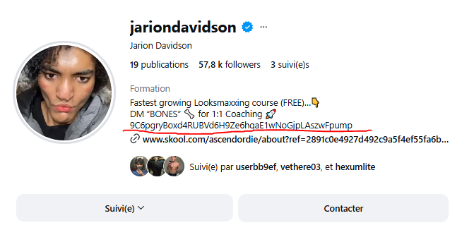 ynkanker's tweet photo. CA: 9C6pgryBoxd4RUBVd6H9Ze6hqaE1wNoGjpLAszwFpump  

Jarion is a viral looksmaxxer who is trying to ascend 

All fees generated are going to be redirected to Jarion so we can help him ascend and get the surgery he needs for his nose   

Hes onboard and super bullish lets help him!

https://t.co/b2XAYNGQIS
https://t.co/UldybcVw1G