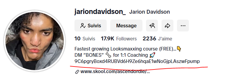 ynkanker's tweet photo. CA: 9C6pgryBoxd4RUBVd6H9Ze6hqaE1wNoGjpLAszwFpump  

Jarion is a viral looksmaxxer who is trying to ascend 

All fees generated are going to be redirected to Jarion so we can help him ascend and get the surgery he needs for his nose   

Hes onboard and super bullish lets help him!

https://t.co/b2XAYNGQIS
https://t.co/UldybcVw1G