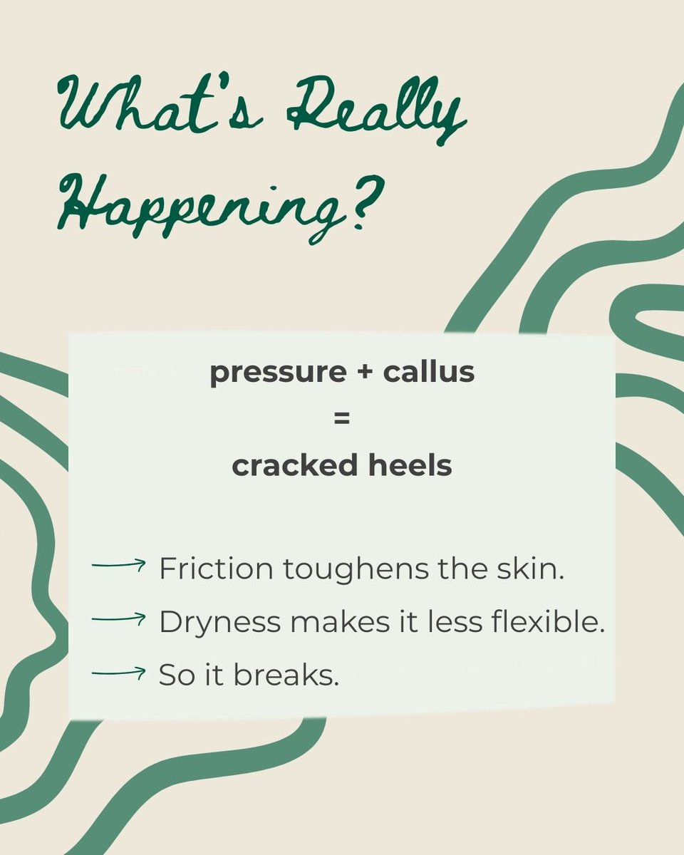 nu119_beauty's tweet image. Fact: Most dry, cracked heels are a sign your feet need consistent moisture + gentle exfoliation.

nū119 makes it easy to keep feet soft without over-scrubbing or harsh tools. A little routine goes a long way.

#nu119 #CrackedHeels #DryFeet #SelfCareRoutine #AtHomeSpa