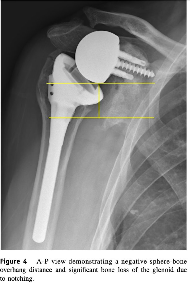 Rick Matsen tweet media