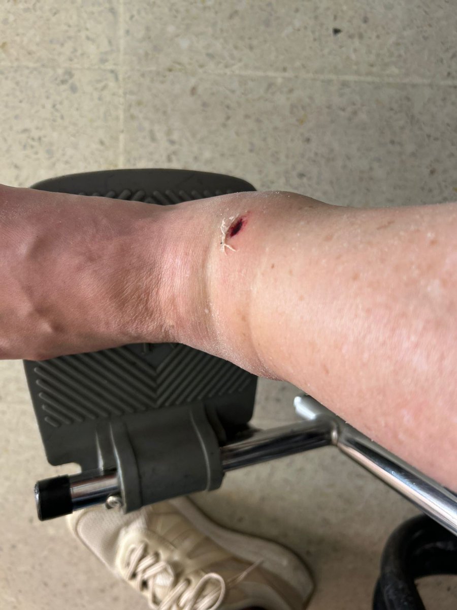 Gata en el tejado🐈‍⬛🇵🇸 tweet media