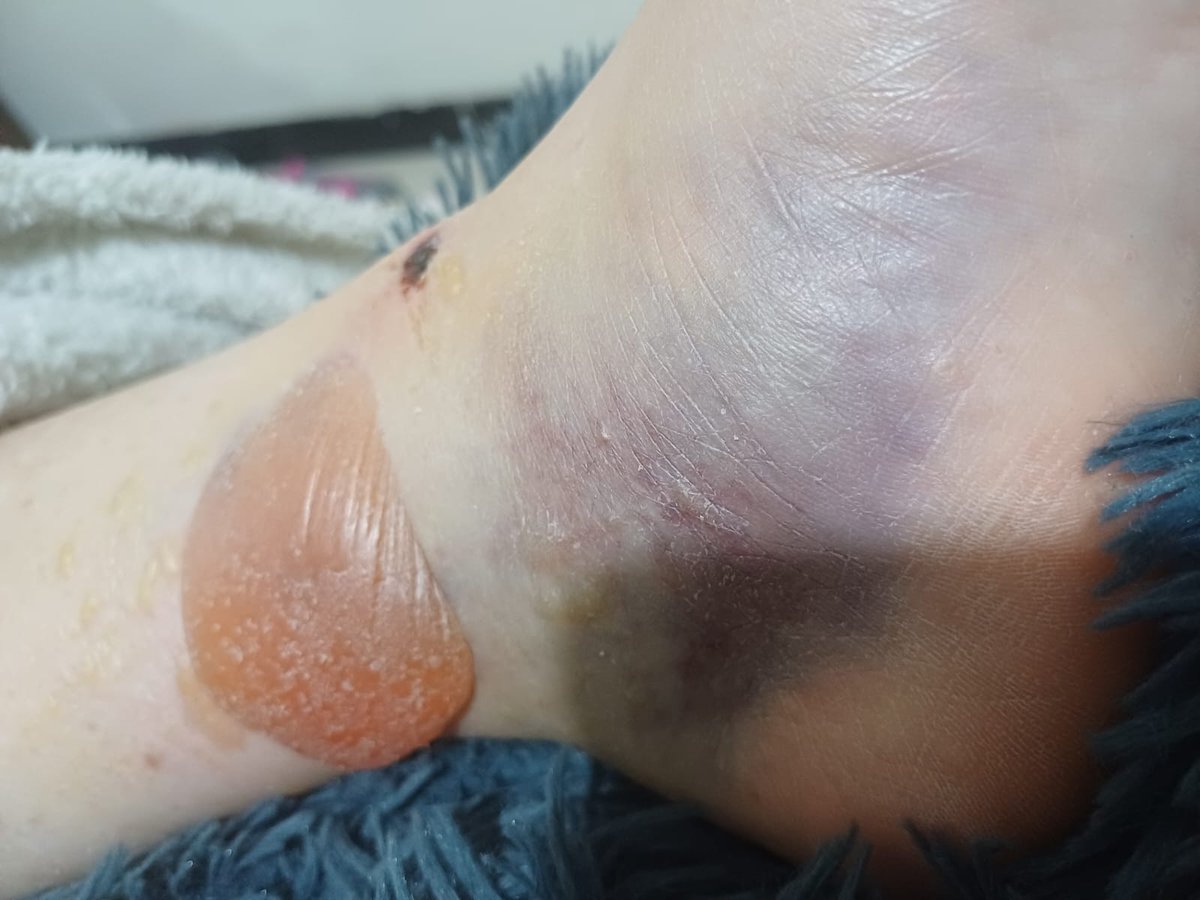 Gata en el tejado🐈‍⬛🇵🇸 tweet media