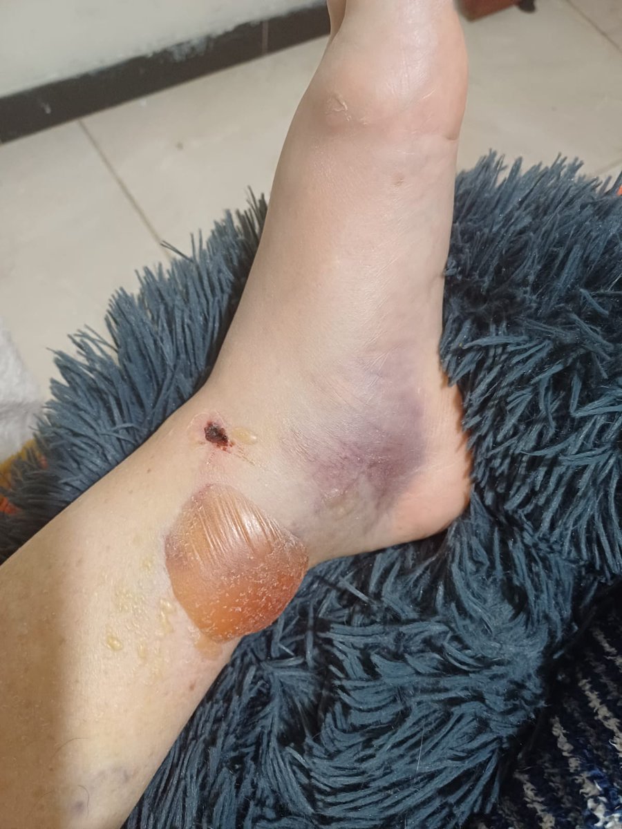 Gata en el tejado🐈‍⬛🇵🇸 tweet media