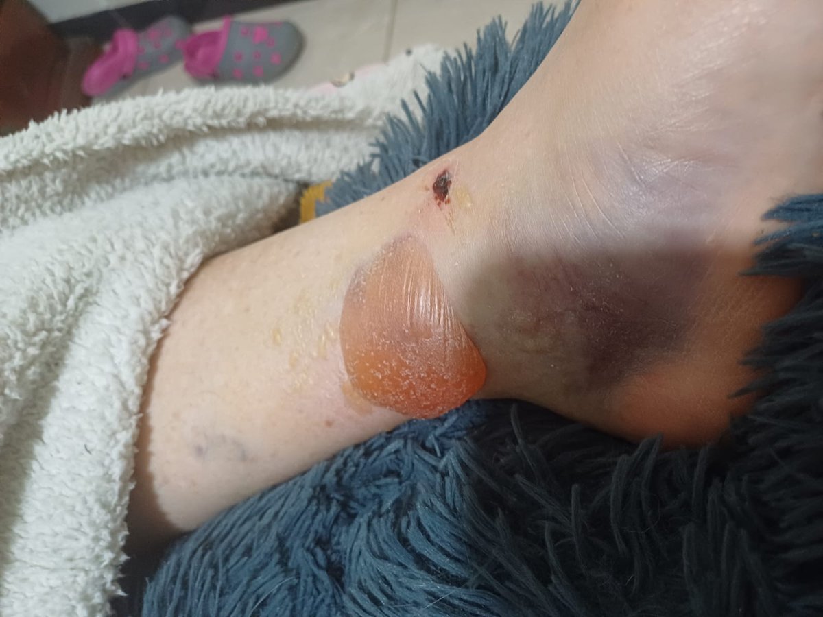 Gata en el tejado🐈‍⬛🇵🇸 tweet media