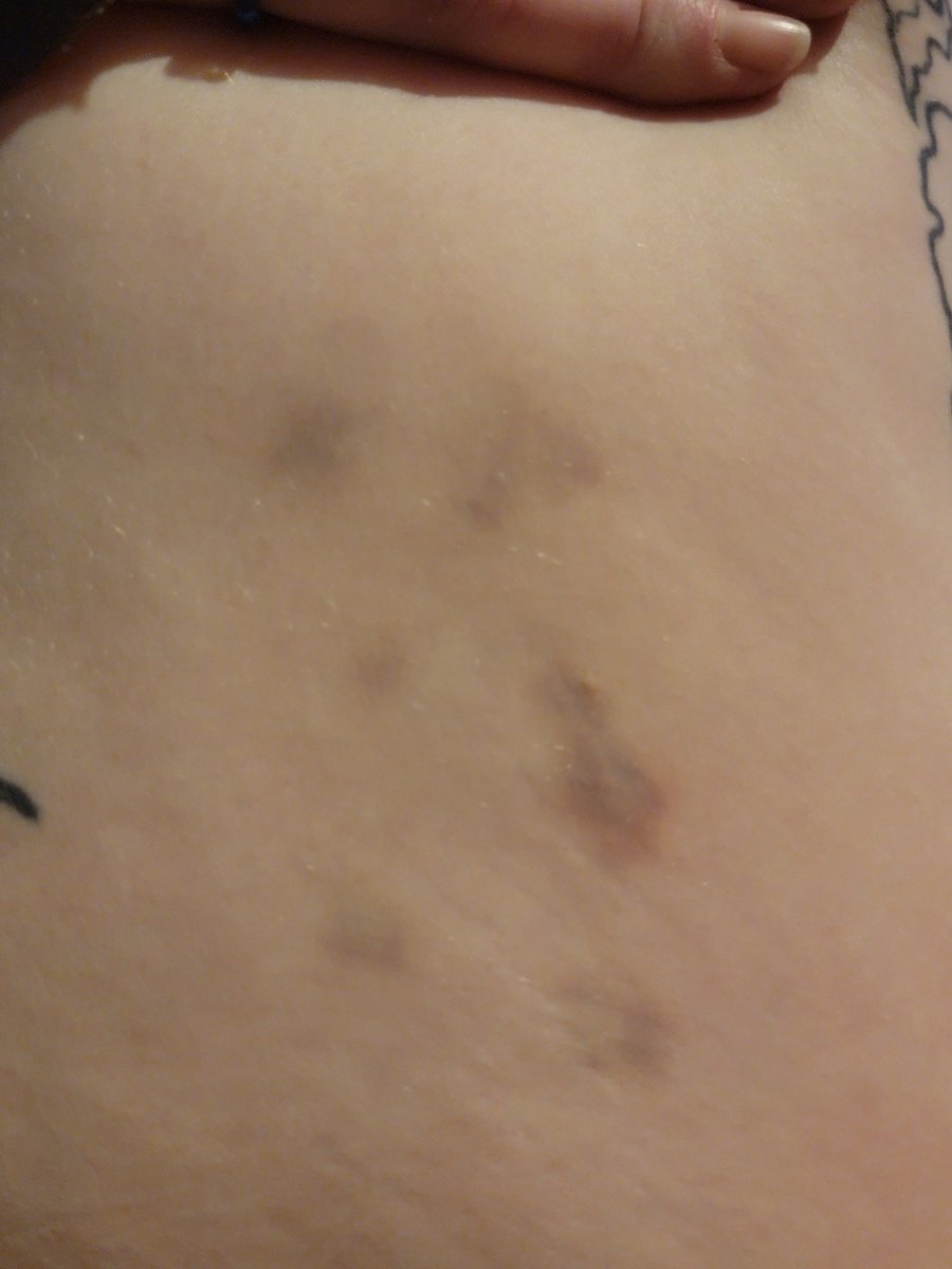 KittehGrey's tweet photo. Don't you wish you were the one leaving marks all over my thighs? 😘👀 https://t.co/e2GyNwv6C7