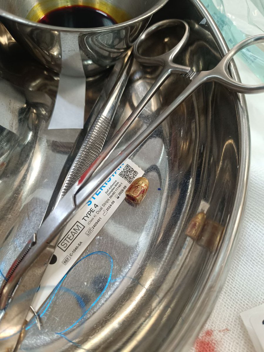 MahmoudZibaie's tweet image. یکی از دوستان صمیمی ام که نزدیک به 30 ساله استاد دانشگاه در ایران است در شب اول فراخوان شاهزاده، در منطقه تهرانپارس مورد اصابت گلوله قرار گرفت.
همان شب به بیمارستانی در تهران مراجعه کرد اما پزشکان با عجله و ترس از اینکه دستگیرش کنند و به او تیر خلاص بزنند فقط به پانسمان اکتفا می…