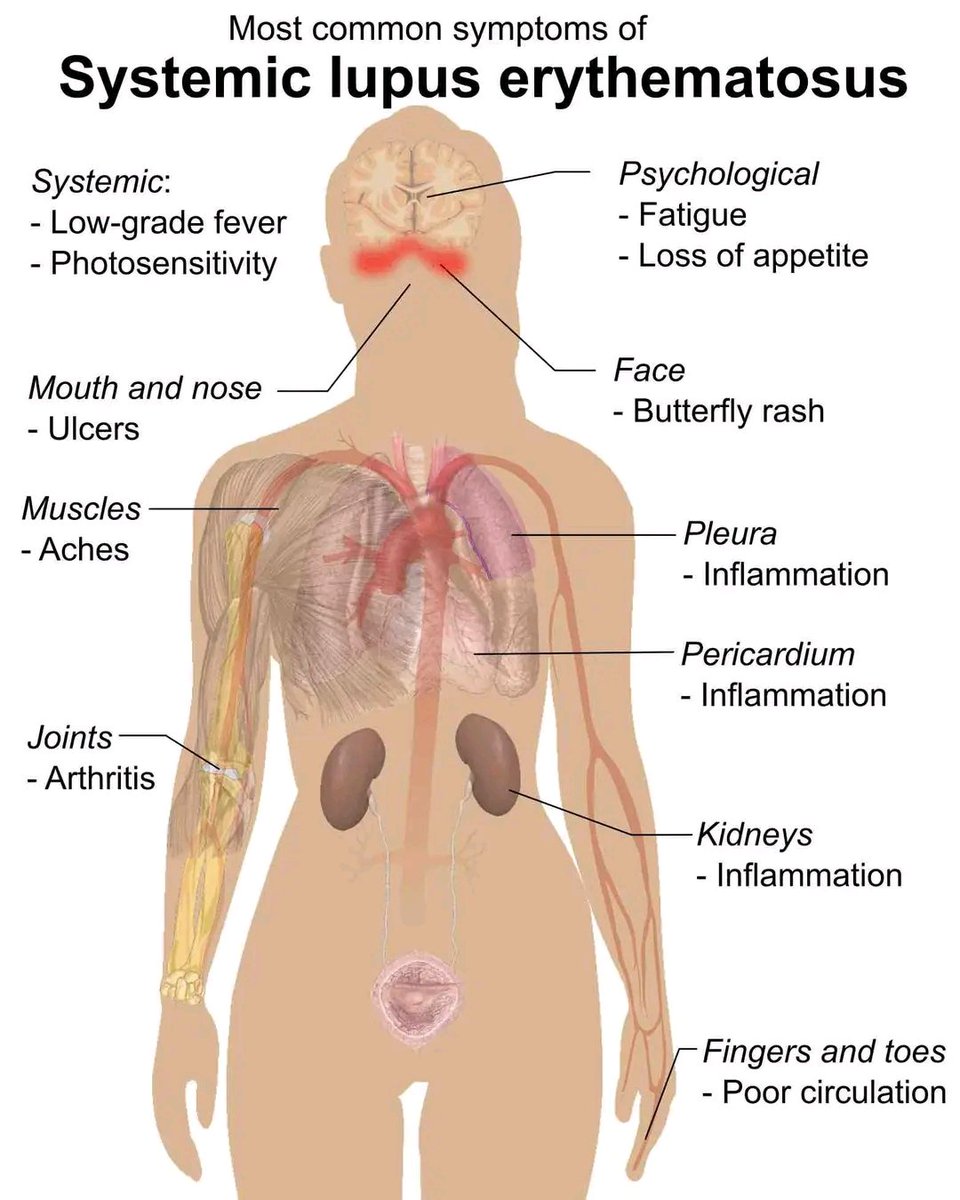 the_medpulse's tweet photo. Know this. Save this. Thank me later. https://t.co/ZrbW9UUWxR