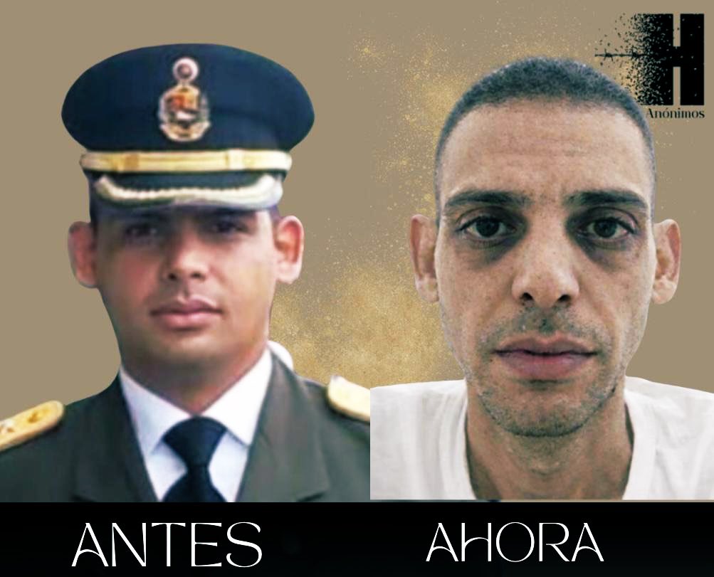 🆘 LLAMADO DE AUXILIO 
Causa GEDÉON.
INTERVENGAN EL CENTRO DE EXTERMINIO 
FUERTE GUICAIPURO
Imágenes del Capitan Juan Luis Gutierrez Aranguren. 
Estas imagenes muestran la realidad de los verdaderos preson de conciencia . Esos héroes ɔue desaparecen en campo de extermino , esos