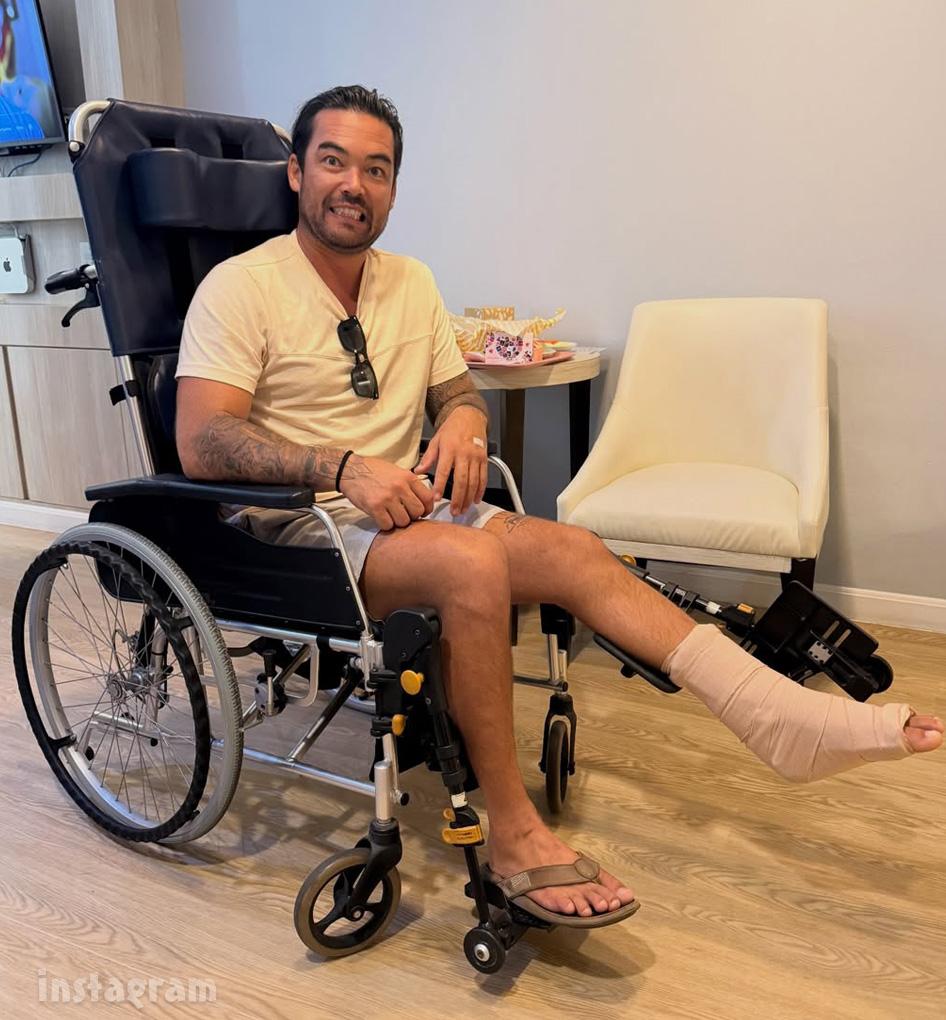 starcasm's tweet image. NOOOOO! #BelowDeck #SailingYacht engineer Colin McRae reveals he suffered a serious injury while playing rugby with friends over the weekend.

"Snapped my Achilles clean in half, and had to have surgery to join it back together," Colin captioned a gallery of photos of himself