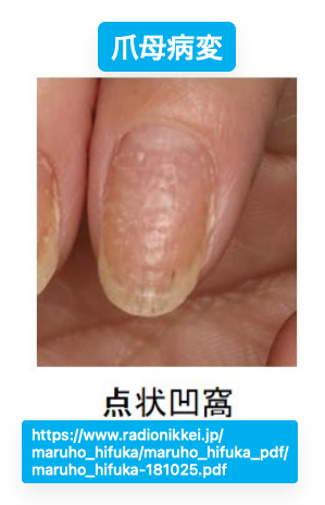 SoS@皮膚科専門医試験対策編 tweet media