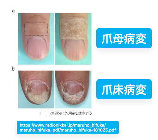 SoS@皮膚科専門医試験対策編 tweet media