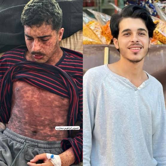 The Palestinian young man Mohammad Dhabban passed away after a long struggle with a rare illness as he was unable to receive treatment outside the Gaza Strip due to travel restrictions.