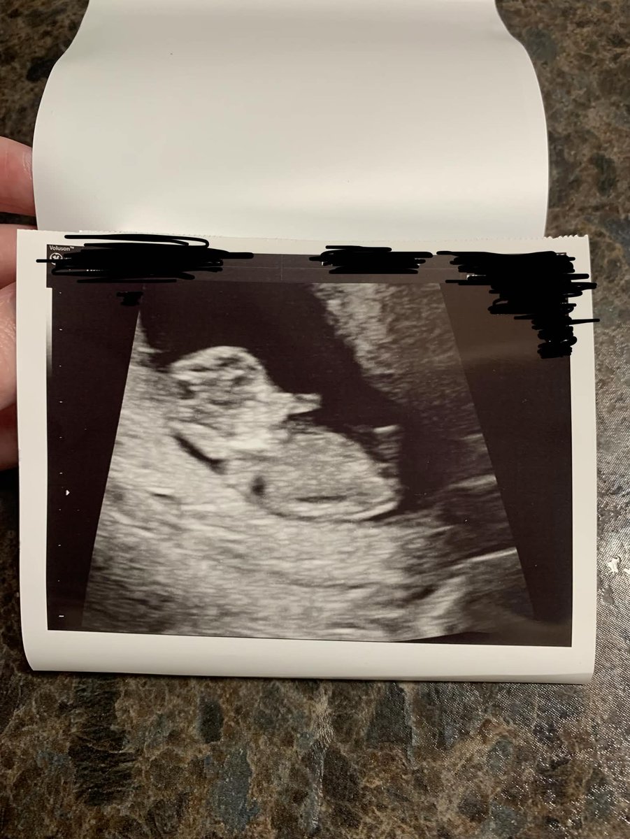 Brian 💾 tweet media