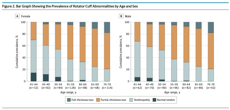 shamteppo's tweet photo. 👉 Key finding:

Rotator cuff imaging abnormalities in people over 40 are almost universal.

99% had at least one imaging abnormality
78% of full-thickness tears were found in asymptomatic shoulders

Imaging findings ≠ pain. https://t.co/zVNUN3vtYY