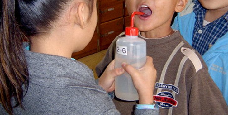 불소… 우리 핵교는 수욜마다 했슨
입에 물고 애들이랑 누가 오래 머금고 있나 시합하고 그랬슨