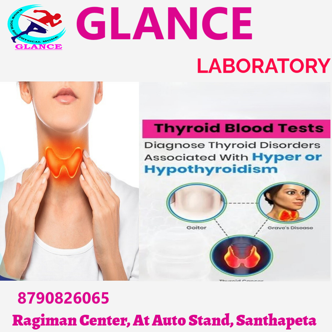 KNOWGLANCE's tweet image. #thyroidtest