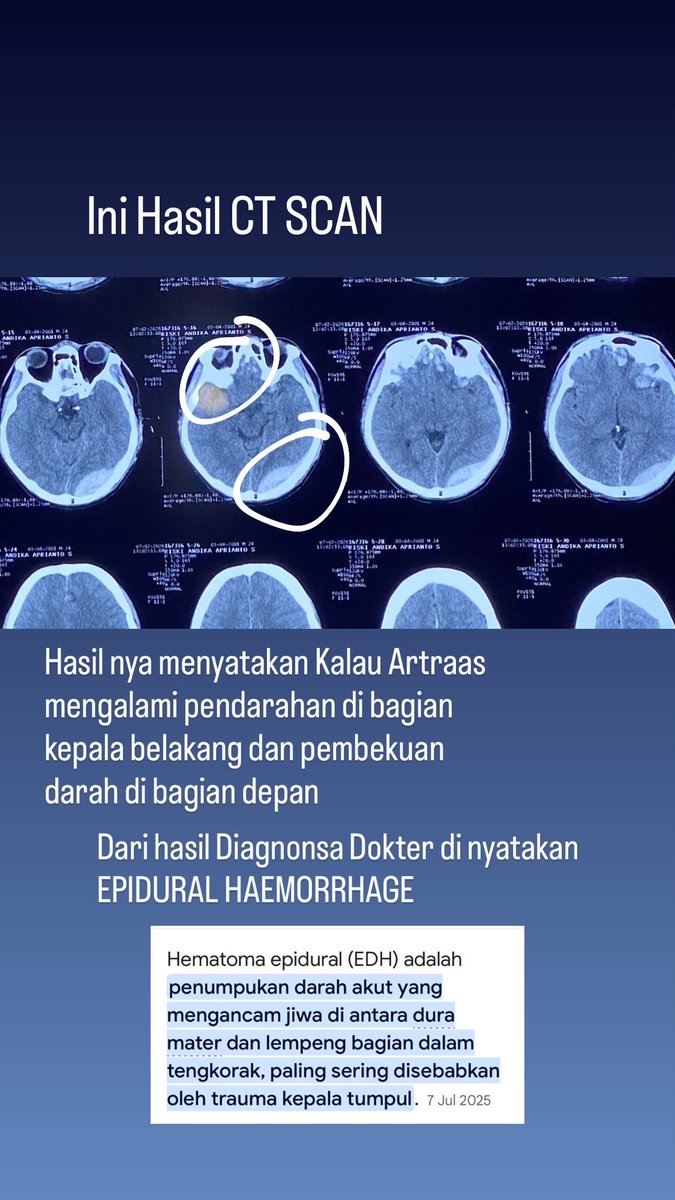 painterrman's tweet photo. Mohon Doa, Bantuan dan Dukungan Buat Artraas semoga kembali sehat dan bisa beraktivitas kembali seperti biasa🙏🏻 
-
-
-
Konfirmasi Donasi
Manager Artraas ( Aziz ) : 082276214520 https://t.co/a5shXL42Gb
