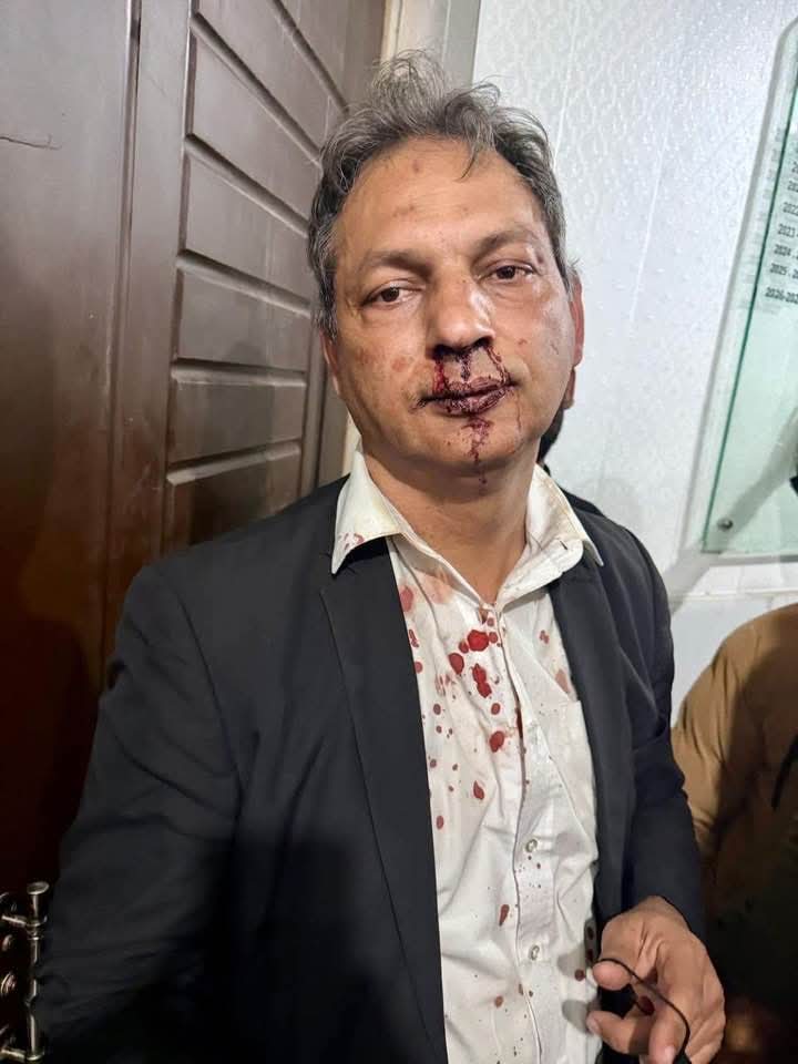 تحریکِ انصاف کے متحرک رہنما اور وکیل یوسف وائیں پر قاتلانہ حملہ قابل مذمت ہے،، یوسف وائیں نہ صرف سیاسی طور پر سرگرم ہیں بلکہ انہوں نے پنجاب بار کونسل کا الیکشن بھی لڑا۔ 9 مئی کے واقعات کے بعد جب سینکڑوں کارکنان مختلف مقدمات میں گرفتار ہوئے تو وہ ان کے دفاع کے لیے عدالتوں میں ڈٹ