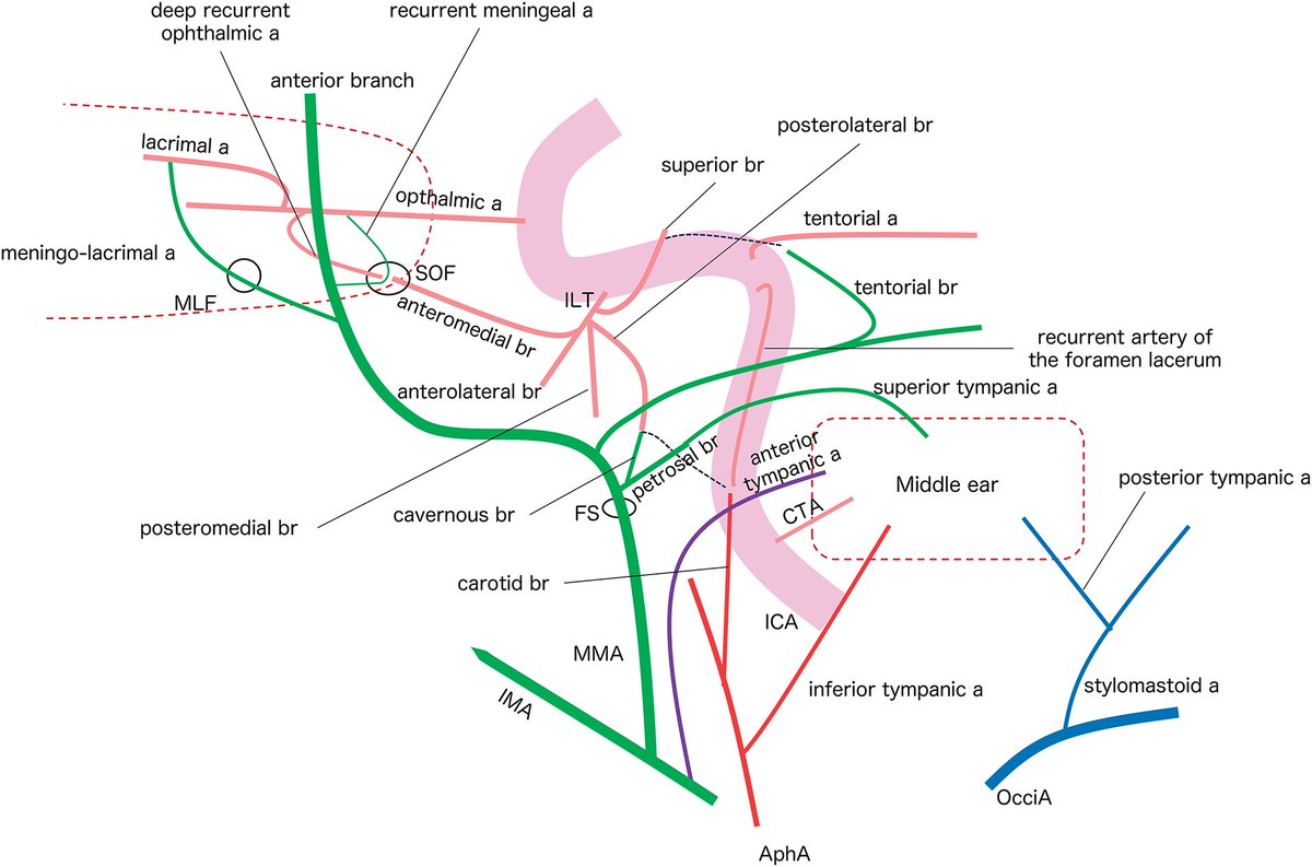 JNET(Journal of Neuroendovascular Therapy) tweet media