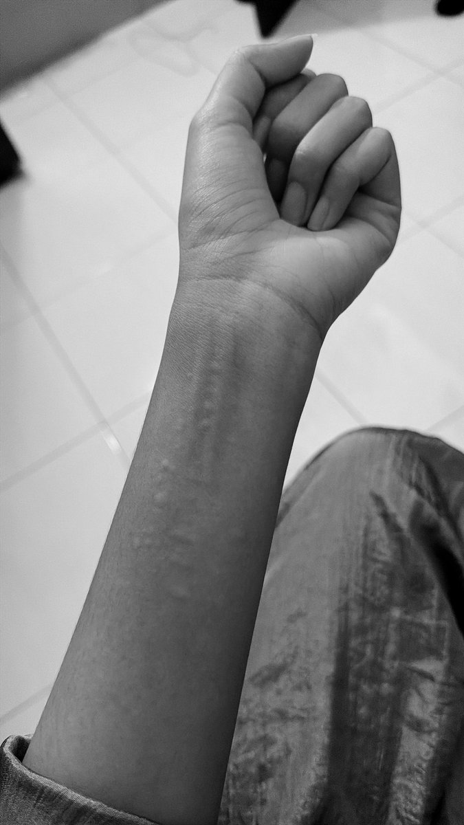 cuttestnn's tweet photo. jngn cb cb selfharm guys, perih, gatel… https://t.co/Hp20Yvt88a