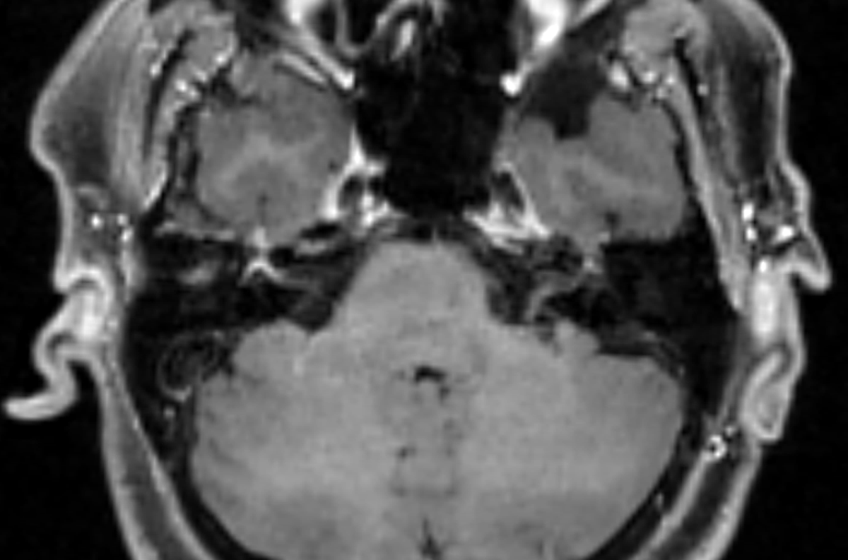 Jack Garnham tweet media