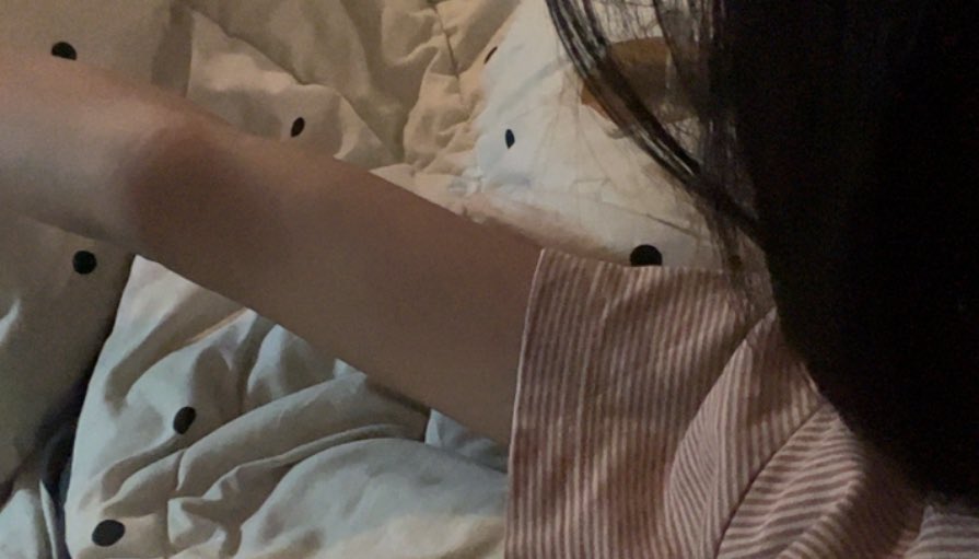 Gixsa160106's tweet photo. แขน หรือ โครงกระดูก https://t.co/uydzrEq4I9
