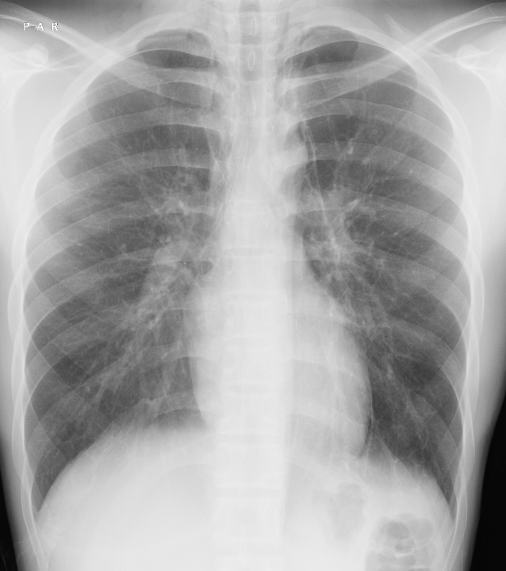 lung-dr | 呼吸器内科医 tweet media