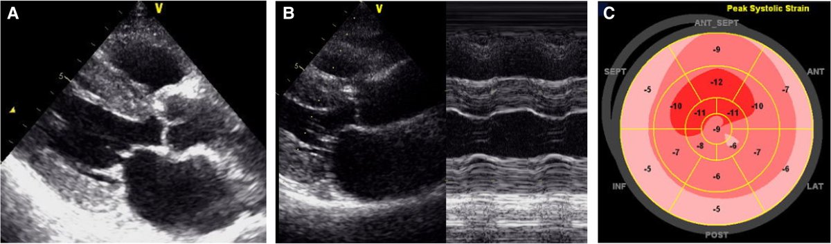 European Society of Cardiology Journals tweet media