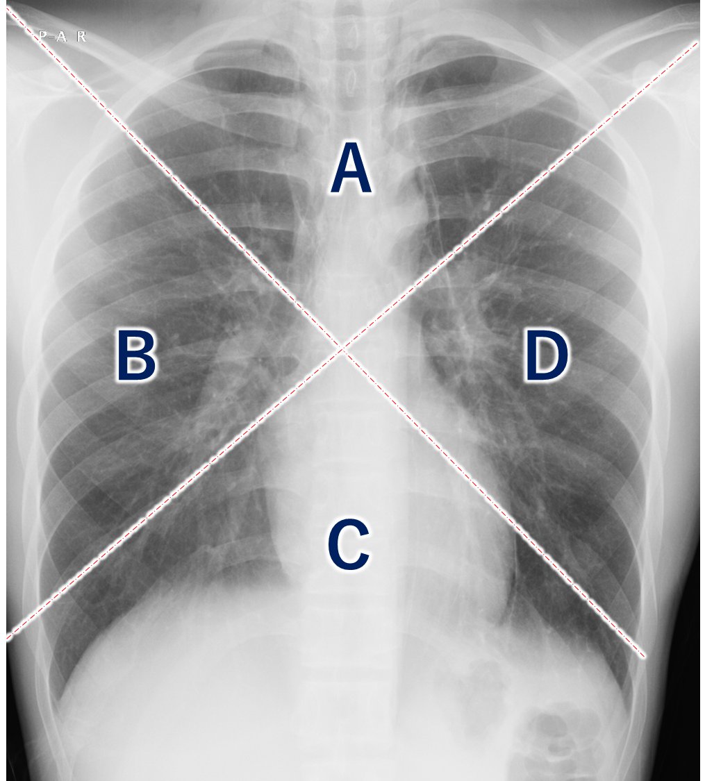 lung-dr | 呼吸器内科医 tweet media