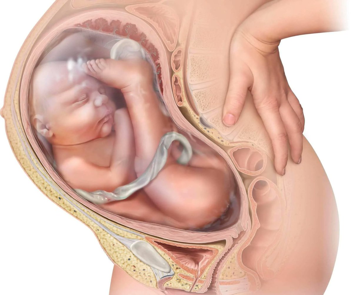 payoo241's tweet image. This position is breech and it's an indication for what???

#ObGyn #MedTwitter