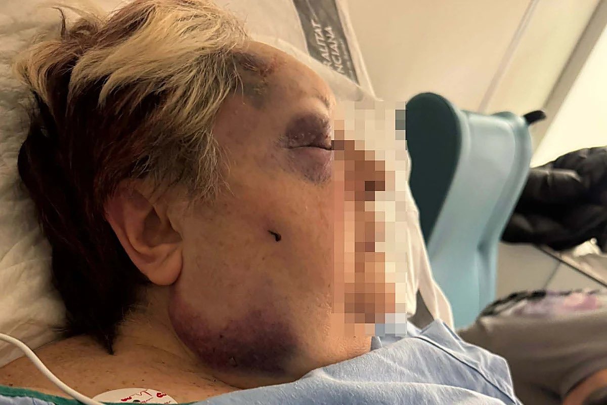 2 magrebíes que ya le habían fracturado 2 costillas a otra mujer y estaban libres,asaltan a una mujer de 71 años en Valencia cuando salía de su domicilio y le roban el bolso.
Al ver que no llevaba nada de valor la tiraron al suelo,la golpearon y le pisaron la cabeza.
…Ahora que?