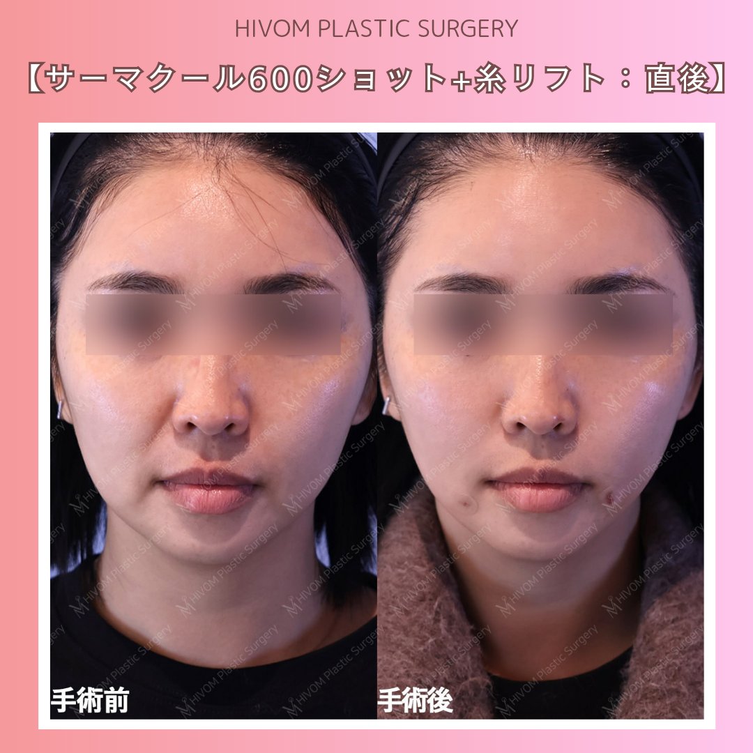 ハイボム美容外科🍑プチ整形🍑 tweet media