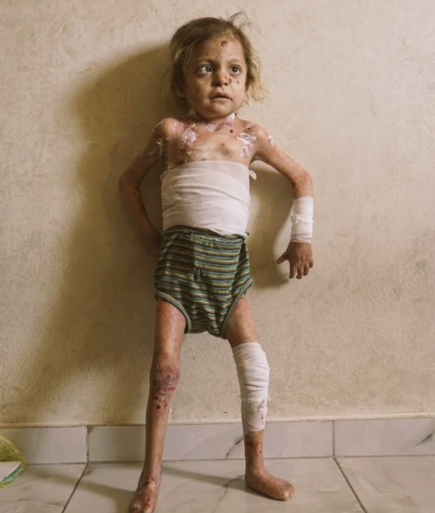 Yousef in Gaza 🇵🇸 tweet media