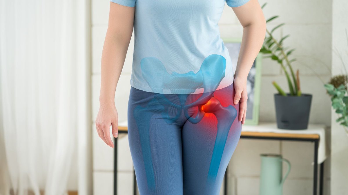 Una investigación demuestra que la pérdida de peso reduce eficazmente los síntomas de la #artrosis de rodilla 

consalud.es/pacientes/obes… vía @Consalud_es