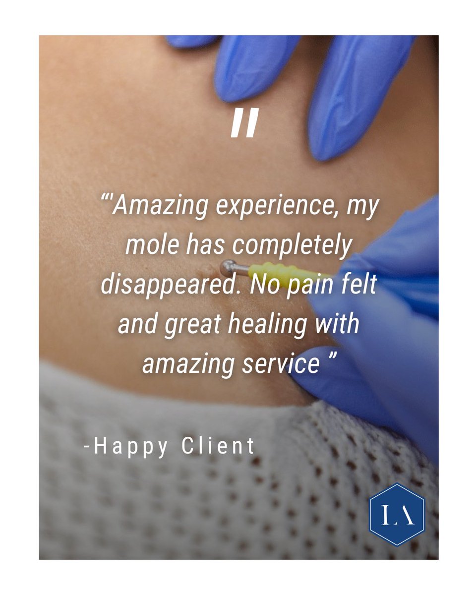 Grateful for another positive mole removal review. 
Every review matters, and I’m so thankful to each patient who takes the time to share their experience. 
#MoleRemoval #SkinTreatment #Diathermy #ClearSkin #Aesthetics #HealthySkin #ConfidenceBoost  #SkinHealth #essex #kent