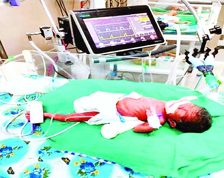 रीवा जिला अस्पताल के एसएनसीयू में 750 ग्राम वजन के नवजात को नई जिंदगी, डॉक्टरों और नर्सिंग स्टाफ की सराहनीय सफलता।
और जानें: starsamachar.com/750-gram-newbo…

#NewbornCare #MedicalMiracle #RewaHospital #SNCU #PrematureBaby #NeonatalCare #HealthcareHeroes #LifeSaved #IndiaHealthcare