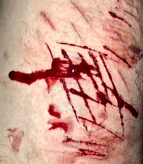 __death__00's tweet photo. Just kept adding to the pile lol #selfharms #shedtwt https://t.co/4VQKXw00QY