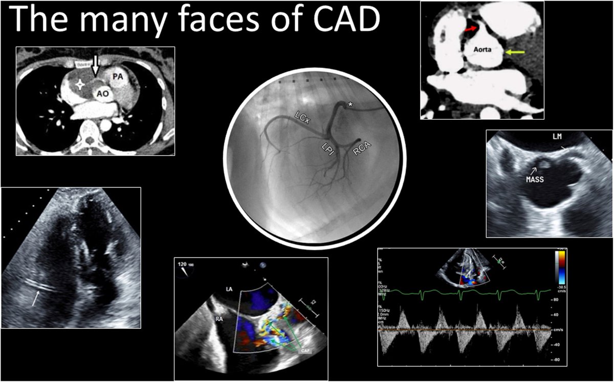V.L.Sorrell, MD (@CASEfromASE EIC) tweet media