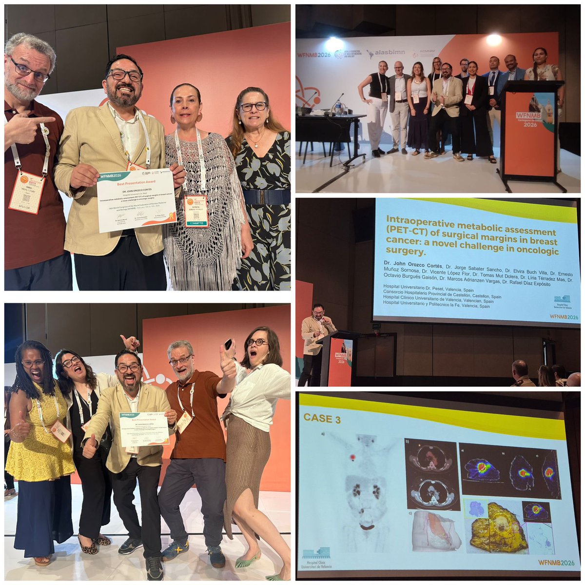 GVADrPeset's tweet photo. 🏆 El doctor John Orozco, del Servicio de Medicina Nuclear de @GVADrPeset ha recibido el Premio a la Mejor Comunicación del 14º Congreso Mundial de Medicina Nuclear y Biología #WFNMB2026 celebrado en Colombia por su trabajo sobre cirugía radioguiada y molecular en cáncer de mama https://t.co/74Uvfg1YAX